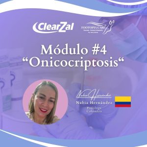 Módulo 4 | Onicocriptosis